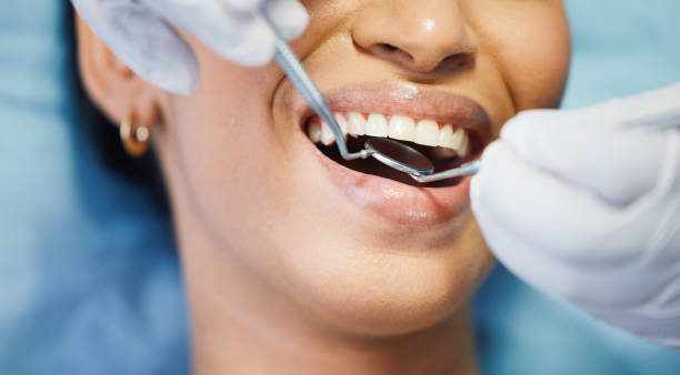 Best Emergency Tooth Extraction in Crystal Lake, FL